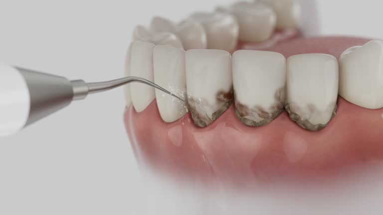 Trusted Tooth Extraction service in West Lake Hills, TX - Dentist Open Now